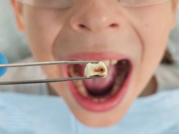 Best Pediatric Emergency Dentist in Lake Placid, FL